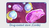 Cordis Drug Coated stent